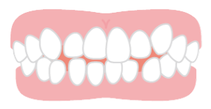 歯並びにお困りの様子